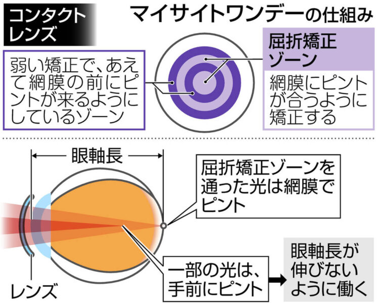 図解 マイサイトワンデーの仕組み